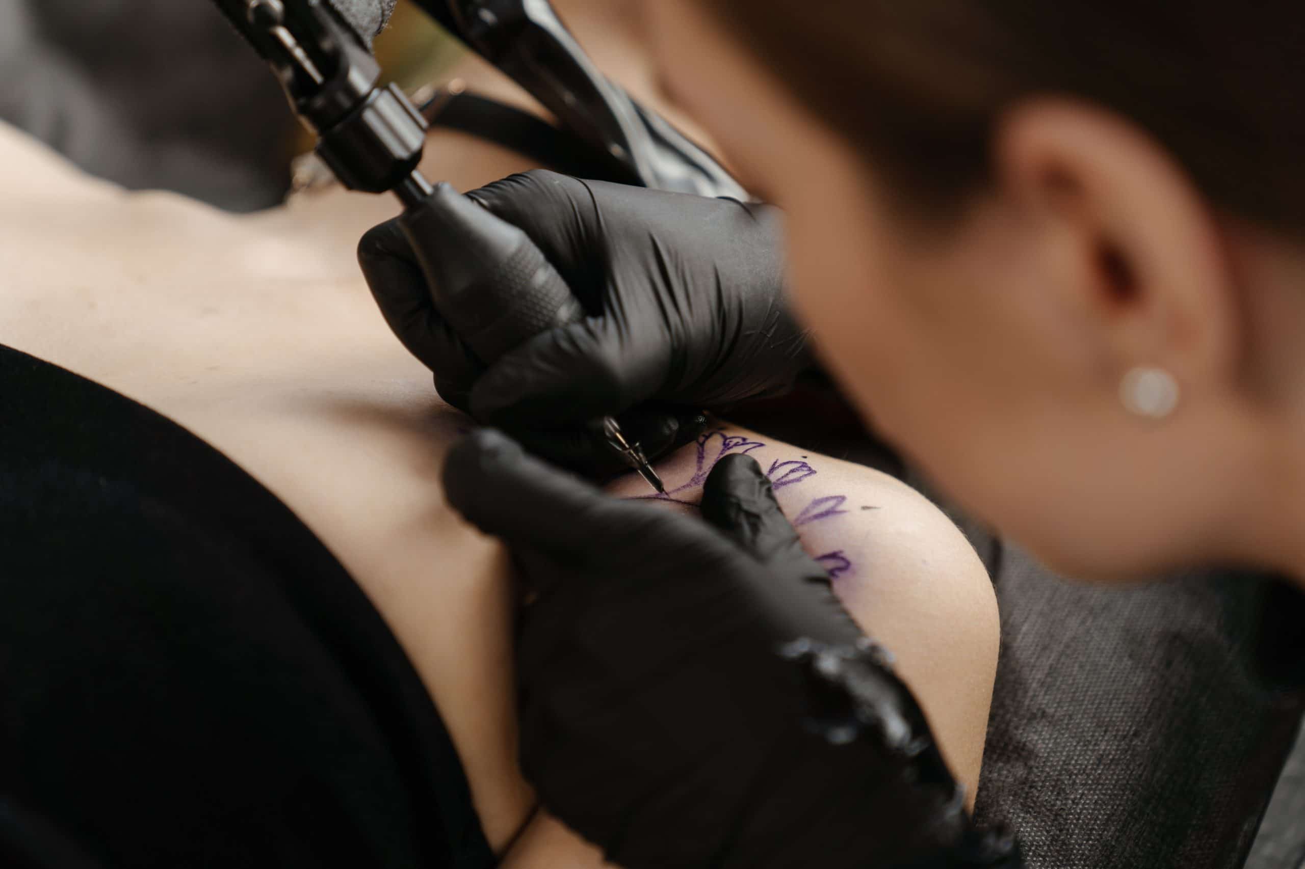 Remove Your Tattoo With Laser Tattoo Removal At Azia Med Spa